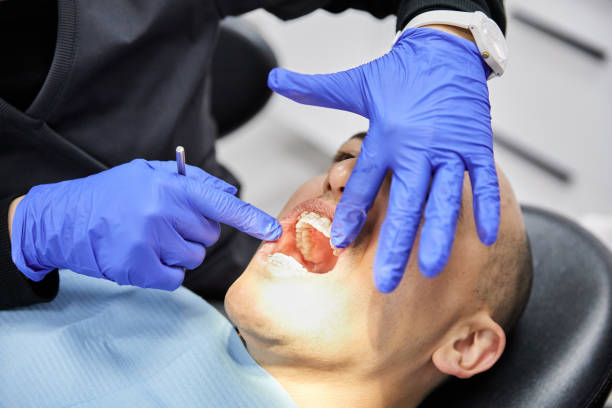 Best Emergency Denture Repair in Baiting Hollow, NY